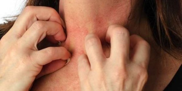Аллергия на глютен: как проявляется и чем лечить